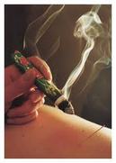 Moxibustion — original practice image